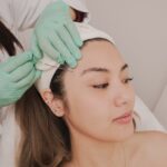 Beyond the Knife: PDO Thread Lifts at Mold Manila for a Natural, Summer-Ready Lift